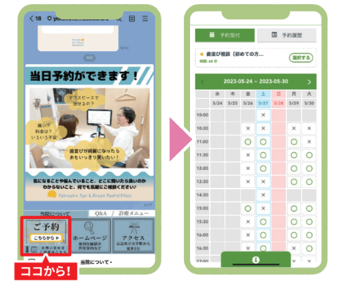 矯正歯科専用LINEから予約