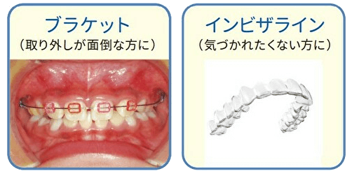 拡大装置・矯正装置