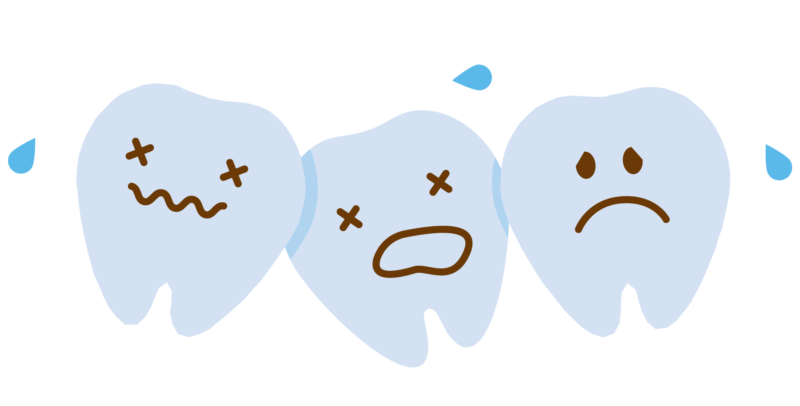 矯正治療中は虫歯ができやすい？もしできたら矯正治療はどうなる？