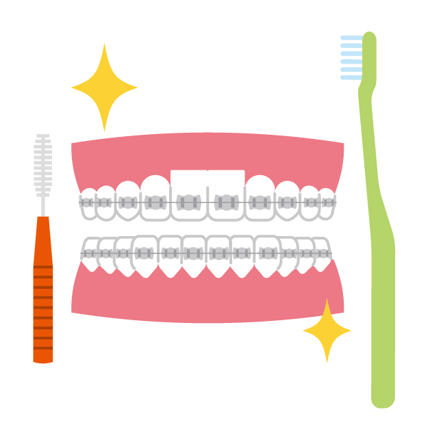 矯正治療中の歯磨きに必要なケアグッズ